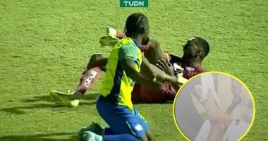 إصابة مؤلمة تعرض لها النجم البرازيلي روماريو دا سيلفا خلال مباراة مثيرة في الدوري الهندوراسي تثير ردود فعل واسعة